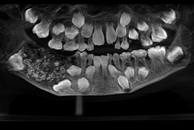 Imagen foto_00000001