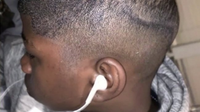 Papás demandaron a colegio por rayar la cabeza de su hijo con marcador permanente