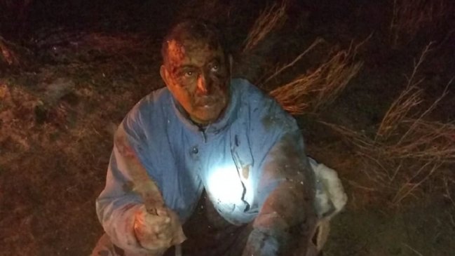 Hombre de 63 años luchó contra un puma para salvar a su perro