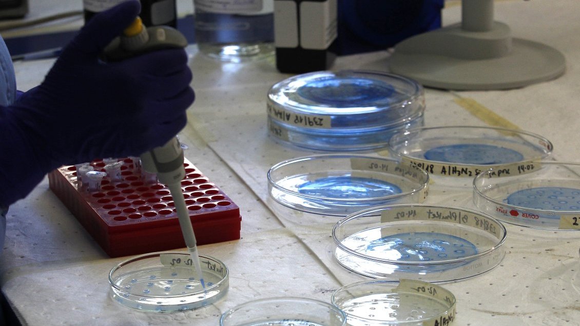 Detectan en Chile 22 casos de infección pulmonar por hongo tropical