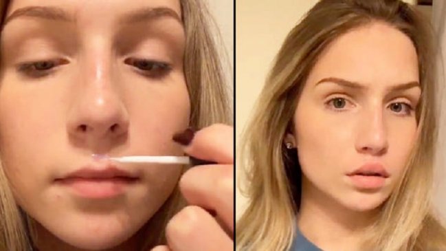 El absurdo y peligroso reto viral con el que personas están usando pegamento en sus labios