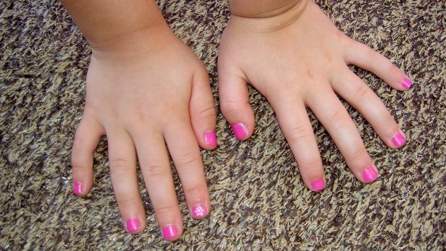 Justicia ordenó otra vez que el Estado costee un carísimo tratamiento infantil