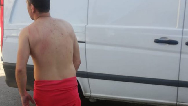 Hombre escapó desnudo ante ataque de prostitutas por no pago