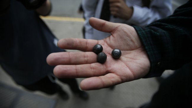 Universidad de Chile entregará prótesis oculares gratuitas