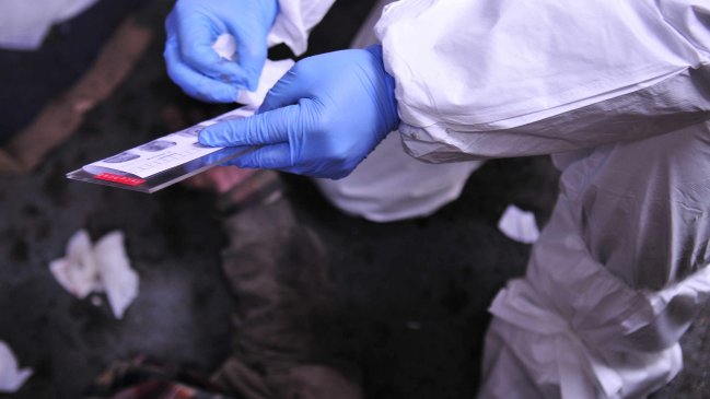 Joven de 22 años falleció en Ercilla tras recibir un balazo en una de sus piernas