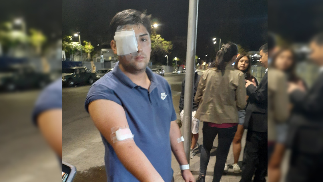 Denuncian que Carabineros disparó perdigones en el rostro y brazos de joven de 19 años en La Granja