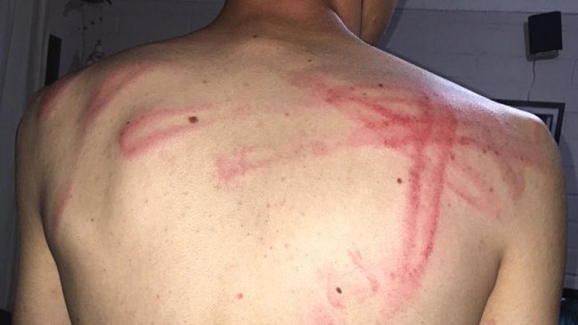 Padres de joven agredido por carabineros presentaron evidencia de la golpiza ante Fiscalía