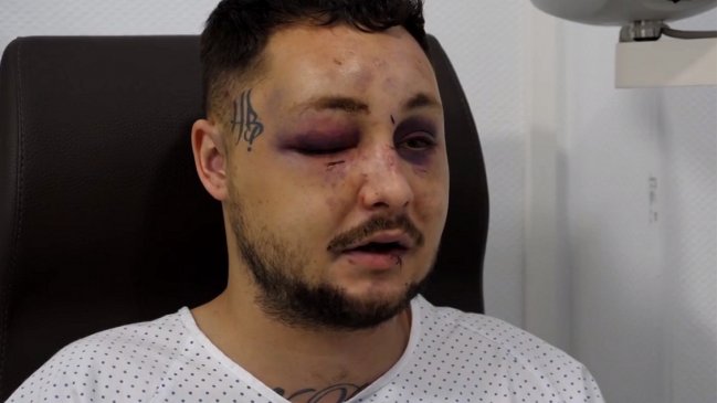 Defendió a una mujer agredida por su novio y recibió una brutal golpiza