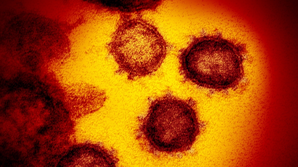 Brasil confirmó segundo caso de coronavirus