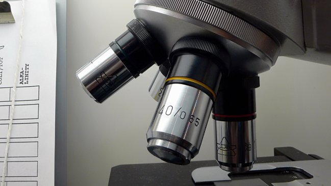 Tests de saliva podrían ser un 