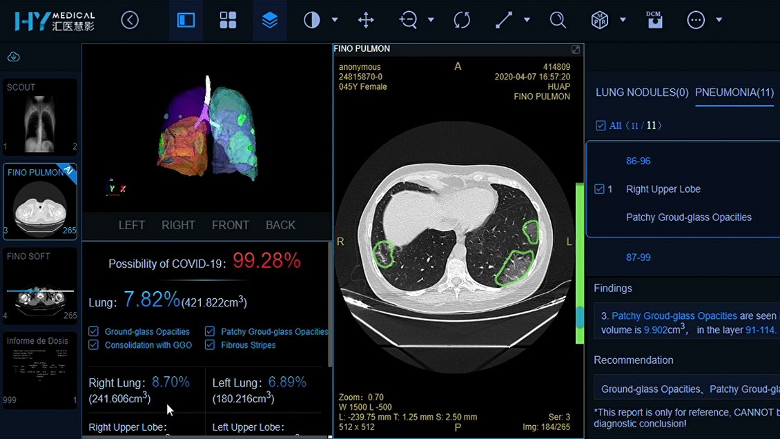 Ex Posta Central usa inteligencia artificial para confirmar en minutos casos de coronavirus