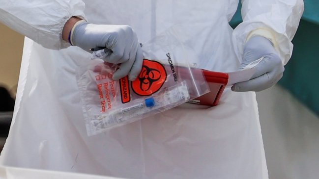 Epidemiólogo: Situación del Covid-19 en Chile 