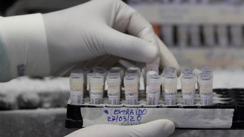 EE.UU. confirmó resultados positivos de fármaco contra el Covid-19