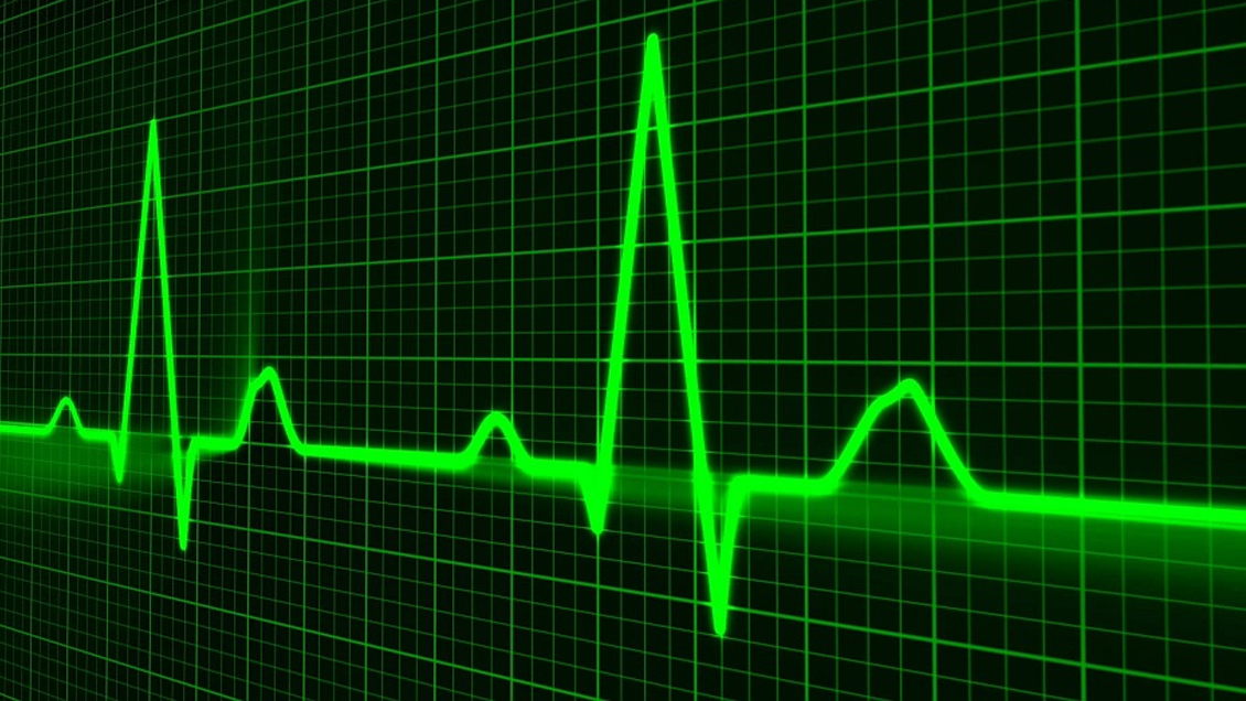 Estudio apunta a graves problemas cardiovasculares asociados al coronavirus