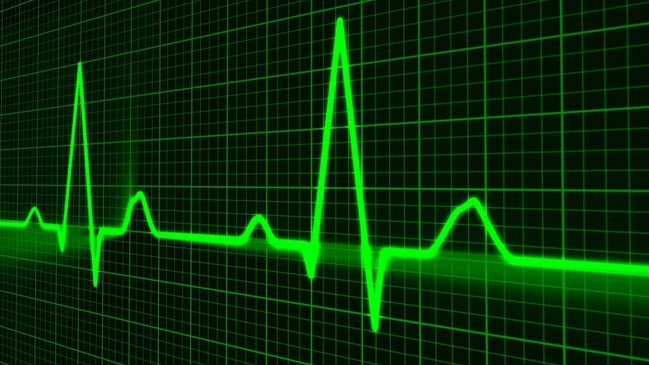 Estudio apunta a graves problemas cardiovasculares asociados al coronavirus