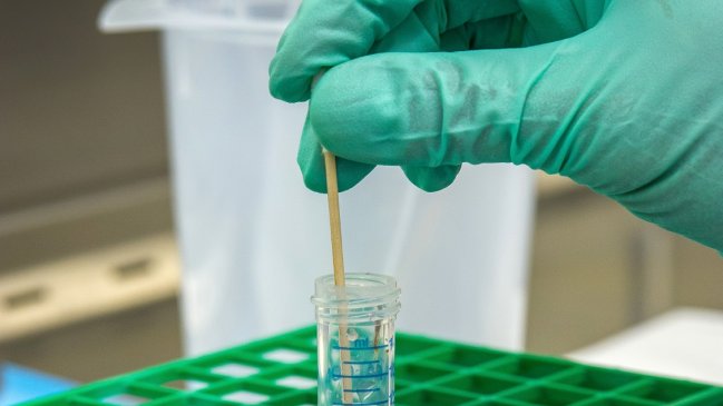 Estudio detectó coronavirus en el semen de pacientes