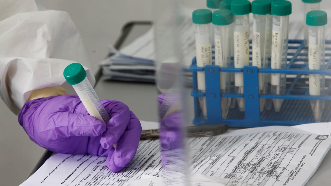 Médico experto: Tratamiento con plasma facilita la inmunidad del paciente con Covid-19