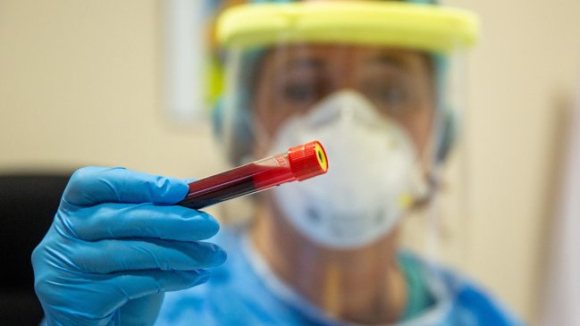 Un grupo sanguíneo se asocia a mayor riesgo de desarrollar Covid-19 más severa
