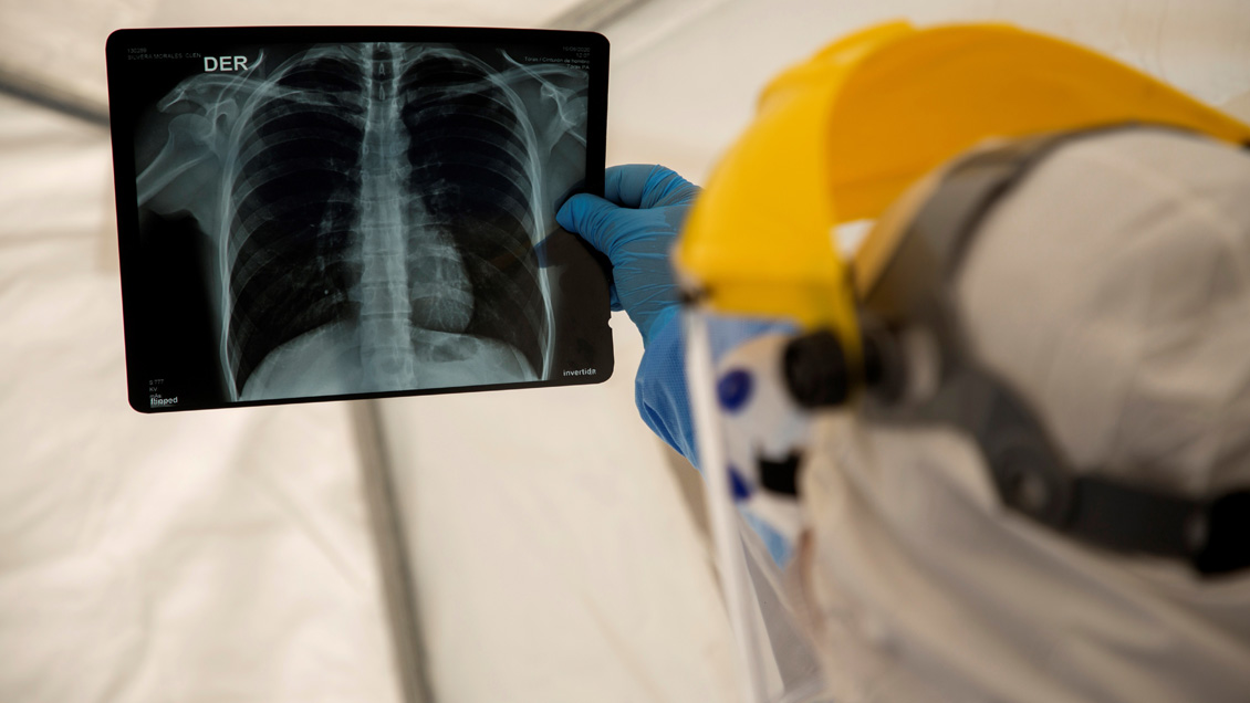 Perú supera los 260.000 casos de Covid-19 al cumplir 100 días de cuarentena nacional