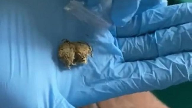 Detectan envío de marihuana a huésped con Covid-19 en residencia sanitaria de Concepción