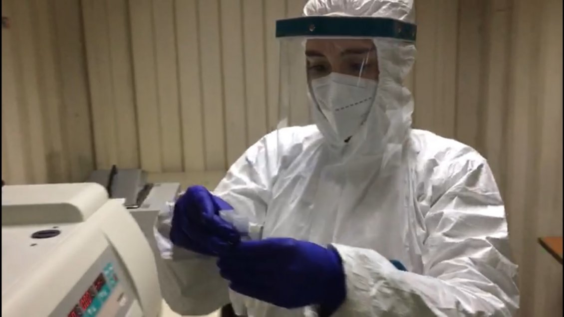 Universidad de Concepción busca el Coronavirus en aguas servidas