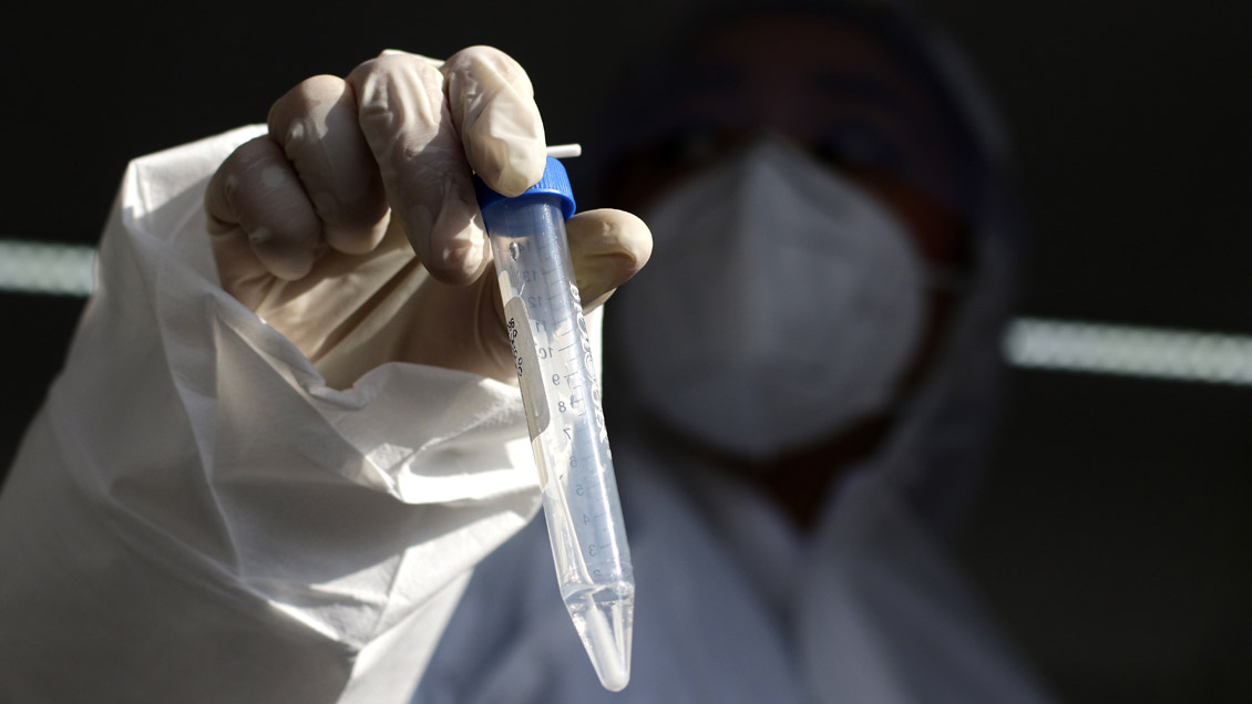 Covid-19: Chile se acerca a los 300 mil contagios y reportó 76 nuevas muertes inscritas