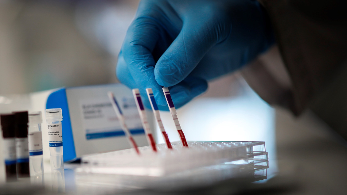 Argentina superó los 90.000 casos de coronavirus tras nuevo récord diario