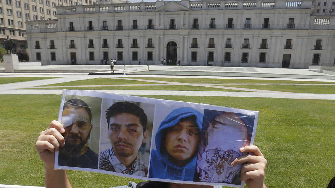 Gobierno admite falencias en implementación de programa de ayuda a víctimas de trauma ocular