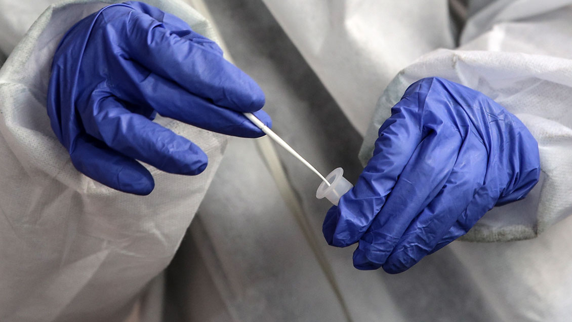 Covid-19: El mundo reportó récord con más de medio millón de nuevos casos en un día