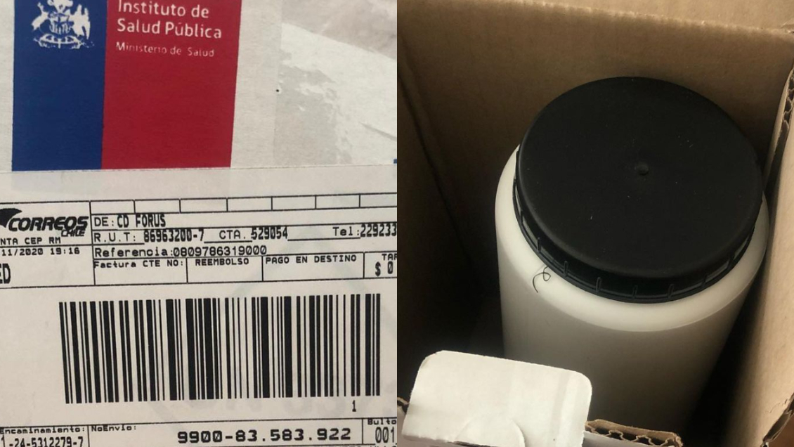 Compró unas zapatillas por internet y le llegaron muestras biológicas del ISP