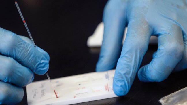 Vacuna de Sinovac suspende ensayos en Brasil por reacción adversa en un voluntario