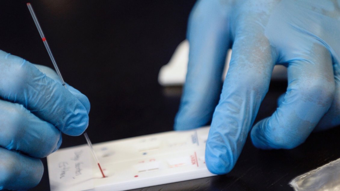 Vacuna de Sinovac suspende ensayos en Brasil por reacción adversa en un voluntario