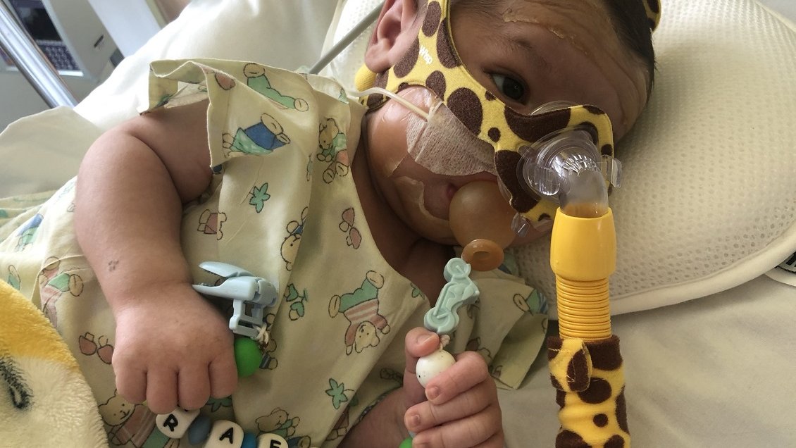 Salvemos a Rafita: Bebé de Talcahuano necesita el medicamento más caro del mundo