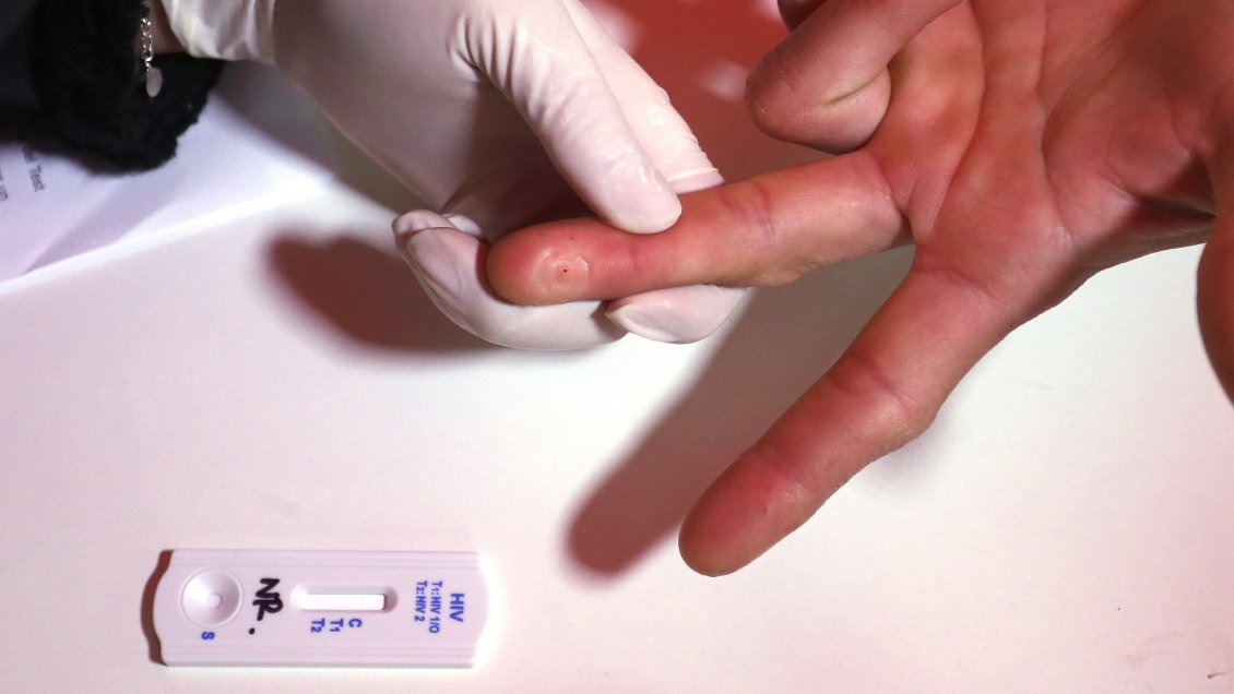 OMS alerta de subida de casos de VIH en Europa y de deficiencias en test