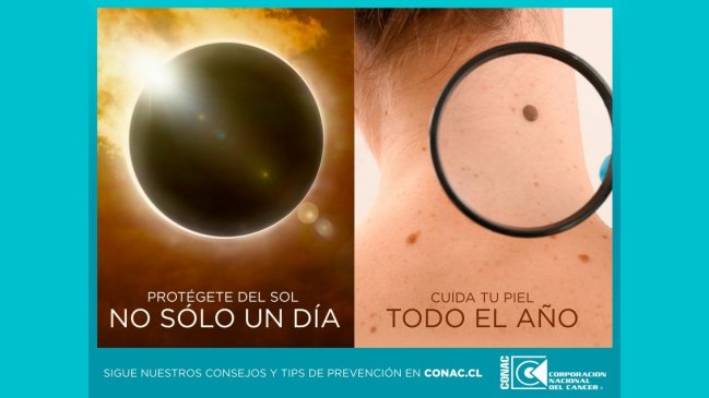 No sólo en verano o eclipses: Conac llama a cuidarse del cáncer de piel todo el año