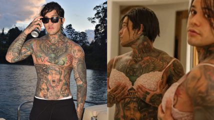  Un youtuber se colocó implantes de senos 