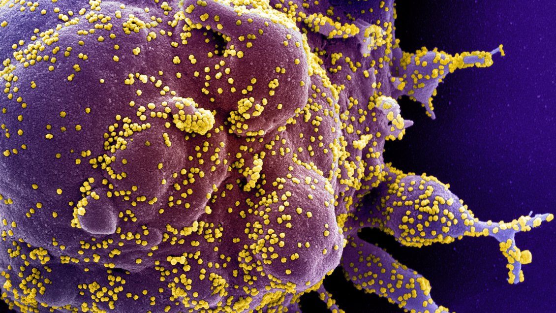 Una nueva variante del coronavirus fue detectada en Ucrania, según regulador
