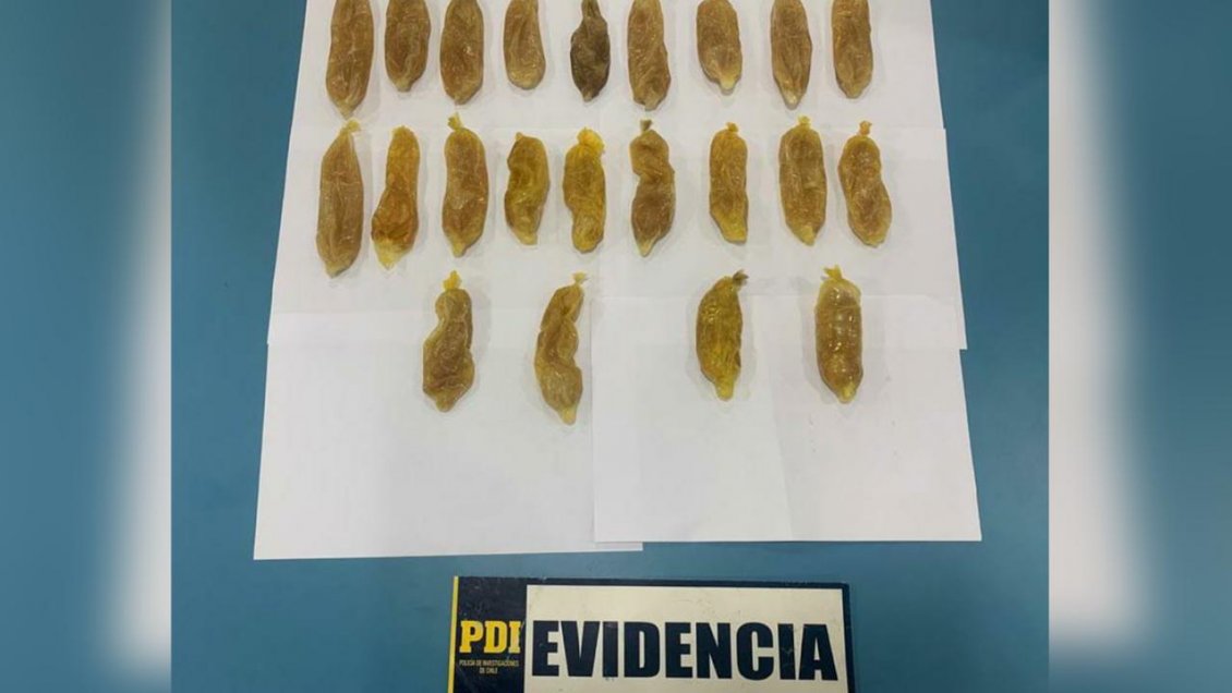 Calama: Mujer trasladada a residencia sanitaria tenía 22 ovoides de cocaína en su estómago