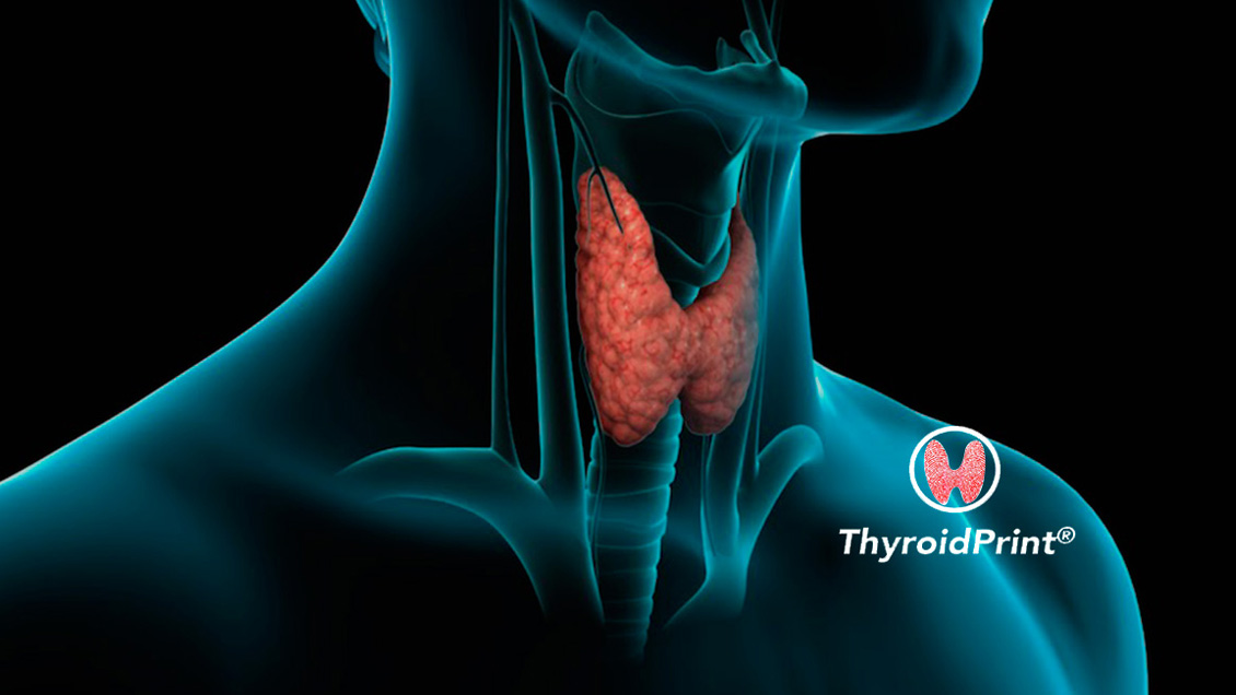 Test de la UC para detectar el cáncer de tiroides ganó importante premio internacional