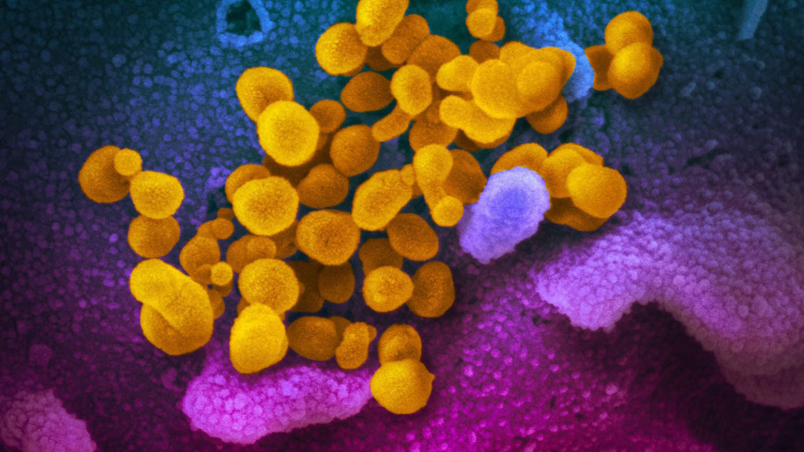 Identifican en Ecuador una variante del coronavirus ya detectada en Chile y Perú