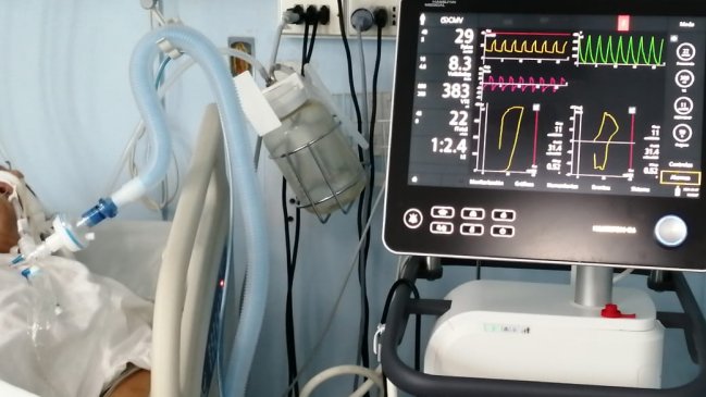 Ocupación de camas críticas en O'Higgins alcanza el 83%