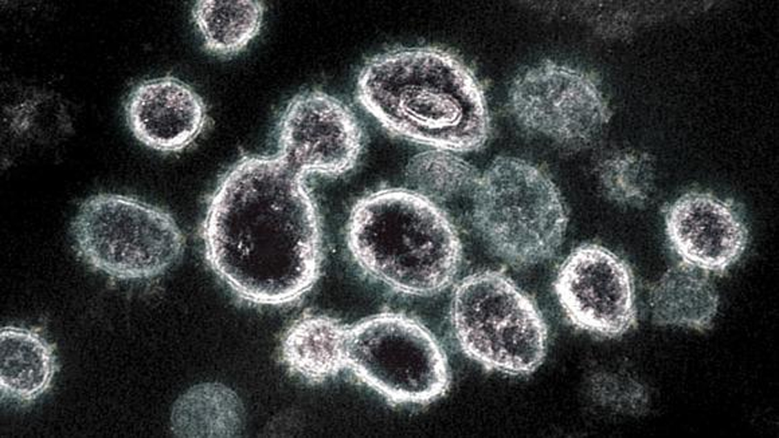 El coronavirus también se transmite por células del sistema inmune