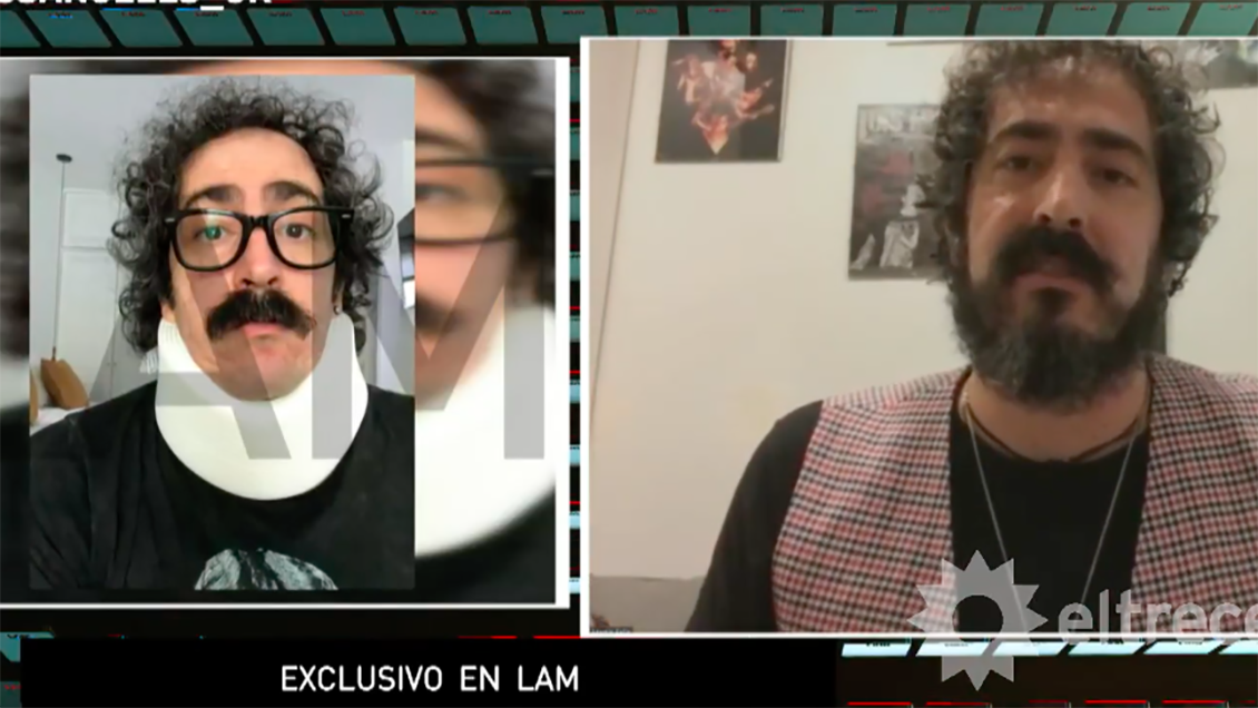 Actor de la serie de Luis Miguel acusa a Diego Boneta de lesiones en rodaje de escena