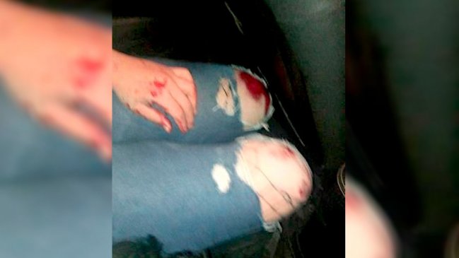 Denuncian a taxista por ataque trans: Víctima sufrió múltiples heridas y un trauma renal