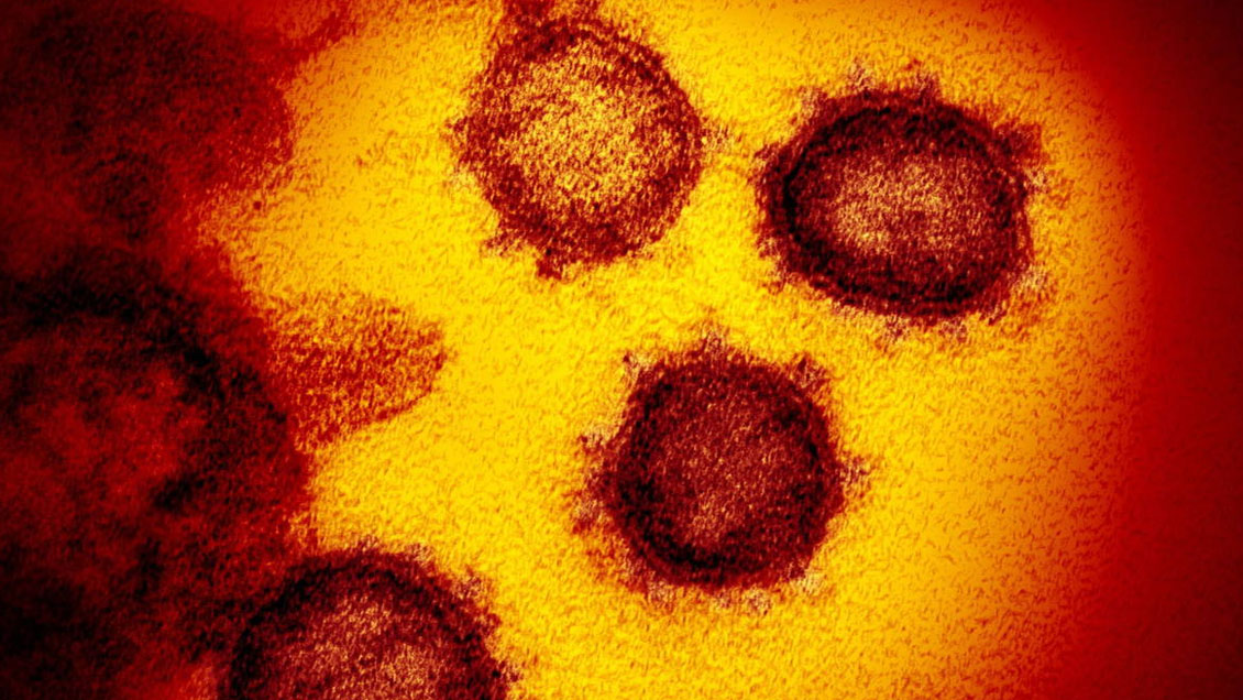 Experto de Oxford: Inmunidad de grupo 