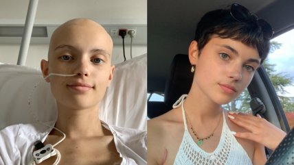   Ola de aplausos: Sobrevivientes de cáncer compartieron su esperanzador antes y después 
