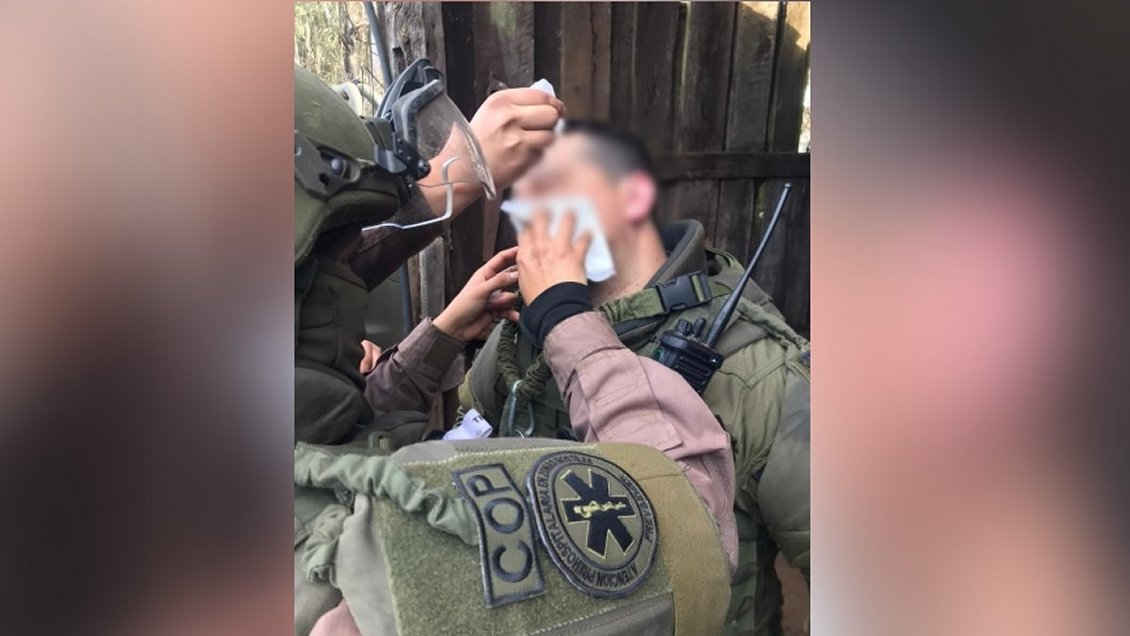 La Araucanía: Carabinero recibió perdigón en el rostro en medio de una emboscada