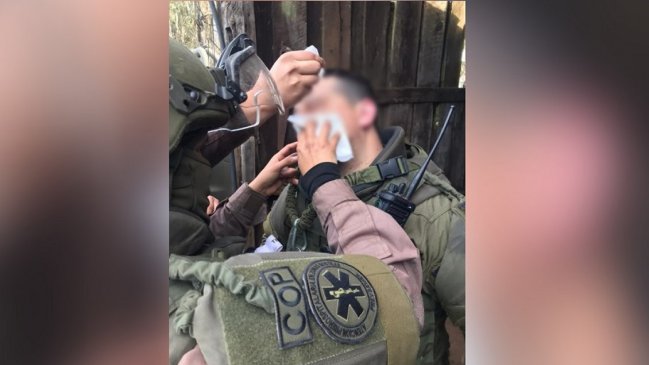 La Araucanía: Carabinero recibió perdigón en el rostro en medio de una emboscada