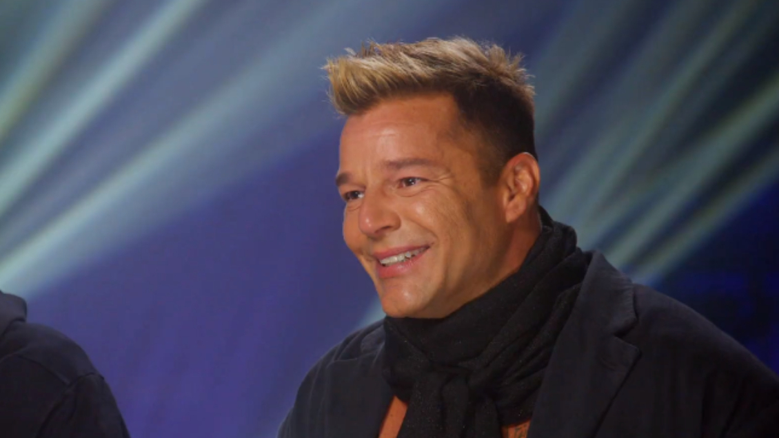 [Fotos] ¿Se puso bótox? Ricky Martin impacta con su 