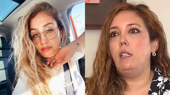 Daniela Castro responde a acusación de mujer que fue mordida por su perro